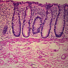 Load image into Gallery viewer, Prepared Microscope Slide, Human Colon, c.s.