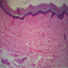 Load image into Gallery viewer, Prepared Microscope Slide, Human Skin, Non-pigmented Normal, H&E
