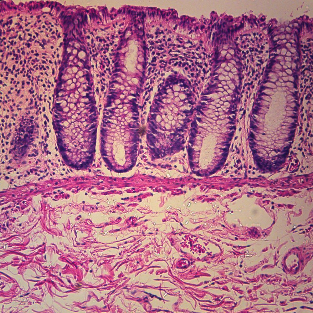 Prepared Microscope Slide, Human Colon, c.s. – lablearner.com